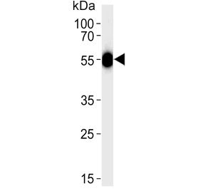 Western blot testing of human blood plasma lysate with Serpin C1 antibody. Predicted molecular weigh