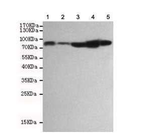 RSK1 / RPS6KA1 Antibody
