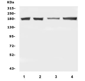 DCC Antibody / Deleted in Colorectal Carcinoma