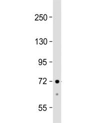Western blot testing of human HepG2 cell lysate with ACSS3 antibody at 1:1000. Predicted molecular w