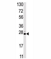 STK19 Antibody