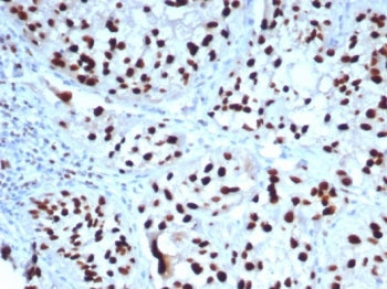 IHC staining of FFPE human bladder tissue with GATA-3 antibody (clone GATA3/7685R). HIER: boil tissu