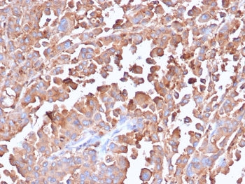 IHC staining of FFPE human colon tissue with recombinant Carcinoembryonic Antigen antibody (clone C6