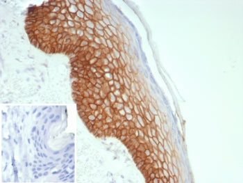 IHC staining of FFPE human skin tissue with DSG3 antibody (clone rDSG3/8612). Inset: PBS used in pla