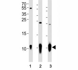 S100B Antibody