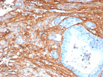 Periostin Antibody