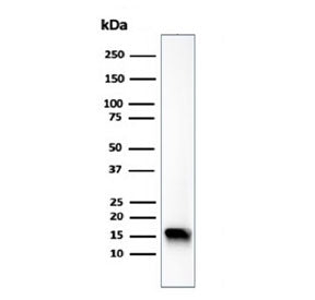 Western blot testing of human HeLa cell lysate using recombinant Fatty Acid Binding Protein 5 antibo