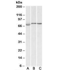 Western blot testing of human [A], mouse [B] and rat [C] testis lysate with DMTF1 antibody at 1ug/ml