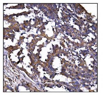 POGLUT1 Antibody / CLP46 / Rumi