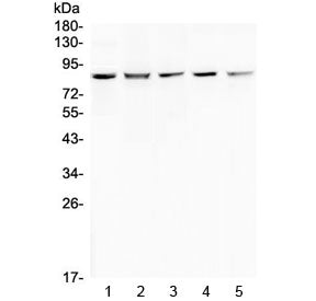 Western blot testing of human 1) HeLa, 2) 293T, 3) COLO-320, 4) SW620 and 5) MCF7 cell lysate with R