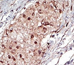 SPHK1 Antibody