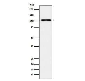 Thyroid Peroxidase Antibody