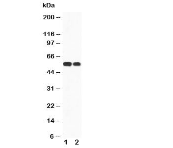 CaMKK Antibody