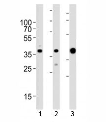 Aldolase Antibody (ALDOA)
