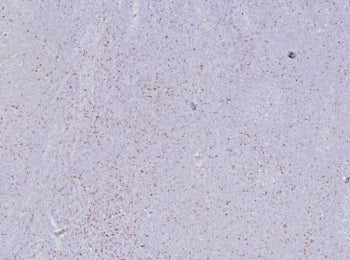 FOXP3 Antibody / Scurfin