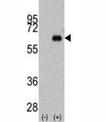 Myc Antibody