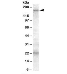 ABCC8 Antibody