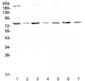 MST1 Antibody (Hepatocyte growth factor-like protein)