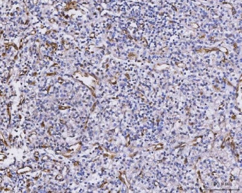 CXCL1 Antibody / GRO alpha