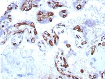 FABP4 Antibody