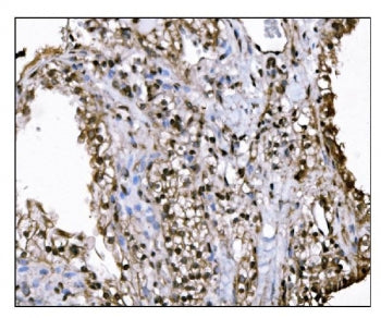 SUV39H2 Antibody / KMT1B