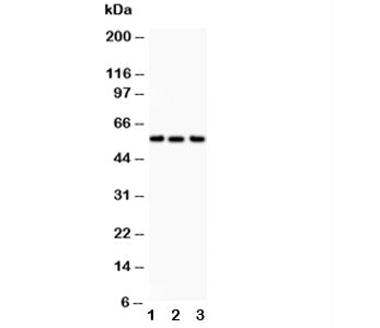 Alkaline Phosphatase Antibody (tissue-nonspecific)