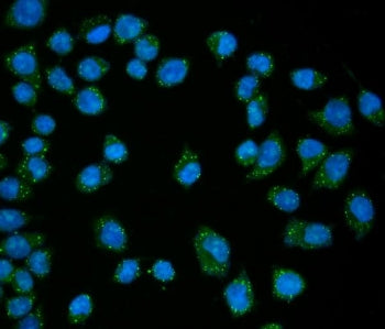 EDC4 Antibody
