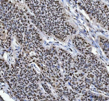 hnRNP L Antibody