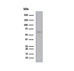 Estrogen Receptor alpha Antibody