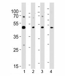 Western blot analysis of lysate from 1) A431, 2) K562, 3) CEM cell line and 4) rat brain tissue usin