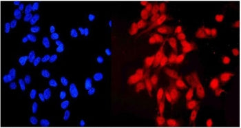 HEC1 Antibody / NDC80