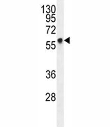 Glypican 3 Antibody