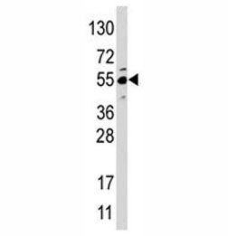 JMJD4 Antibody