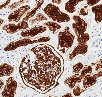 CD10 Antibody / Neprilysin