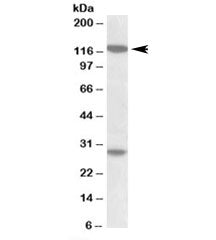 Western blot testing of MOLT4 lysate with UBN1 antibody at 1ug/ml. The expected ~120kDa band and the