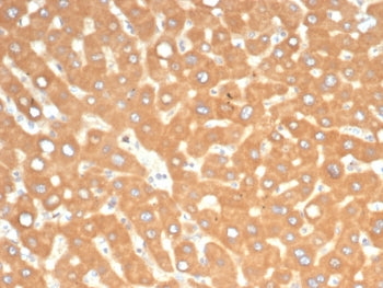 IHC staining of FFPE human liver in colon with EPH Receptor B4 antibody (clone EPHB4/6391). HIER: bo