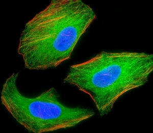 TSC2 Antibody