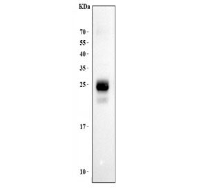 Western blot testing of human Jurkat lysate with HLA-DPB1 antibody at 0.5ug/ml. Predicted molecular 