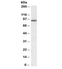 Western blot testing of A431 lysate with PRDM1 antibody at 0.3ug/ml. Predicted molecular weight: ~92
