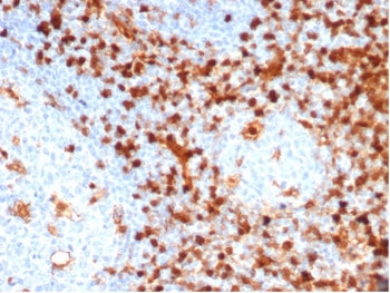 IHC staining of FFPE human tonsil tissue with Annexin A1 antibody (clone ANXA1/6452R). HIER: boil ti