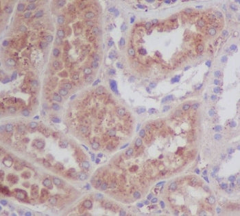ApoE Antibody / Apolipoprotein E