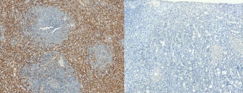 IHC staining of FFPE human spleen tissue with AIF-1 antibody (left) and without AIF-1 antibody (right, negative control). Required HIER: steamed antigen retrieval with pH6 citrate buffer.