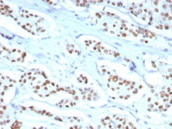 Estrogen Receptor alpha Antibody