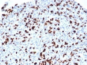 IHC staining of FFPE human lymph node with recombinant TIA-1 antibody (clone TIA/1352R). HIER: boil 