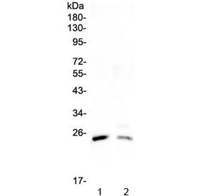 StAR Antibody / Steroidogenic acute regulatory protein