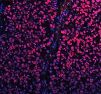Specificity Protein 1 Antibody / SP1