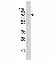 GCN5 Antibody