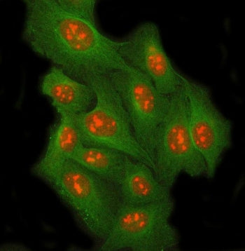 Immunofluorescent staining of FFPE human U-2 OS cells with RRP8 antibody (red) and Beta Tubulin mAb 