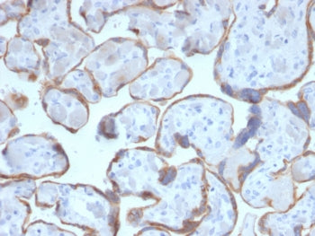 PAPP-A Antibody / Pappalysin-1