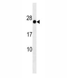 GAGE12F Antibody